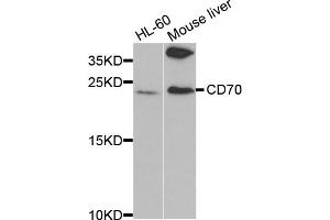 Western blot analysis of extracts of various cell lines, using CD70 antibody (ABIN5971064) at 1/1000 dilution. (CD70 anticorps)