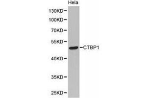 Western Blotting (WB) image for anti-C-terminal Binding Protein 1 (CTBP1) antibody (ABIN1872058) (CTBP1 anticorps)