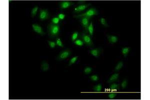 Immunofluorescence of monoclonal antibody to GABPA on HeLa cell. (GABPA anticorps  (AA 1-100))