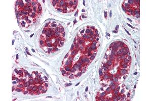 Immunohistochemistry (IHC) image for anti-Cytoskeleton-Associated Protein 4 (CKAP4) (Middle Region) antibody (ABIN2782739)