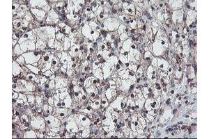 Image no. 4 for anti-RAB, Member of RAS Oncogene Family-Like 2A (RABL2A) antibody (ABIN1500575)