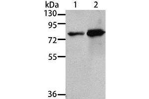 Western Blot analysis of 293T and A431 cell using MSN Polyclonal Antibody at dilution of 1:500 (Moesin anticorps)