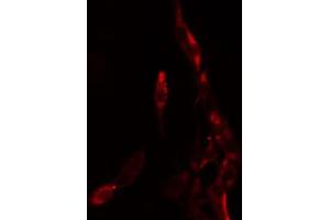 ABIN6274182 staining K562 by IF/ICC. (HOXB9 anticorps  (N-Term))