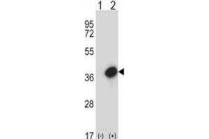 Western Blotting (WB) image for anti-General Transcription Factor IIE, Polypeptide 2 (GTF2E2) antibody (ABIN2997737) (GTF2E2 anticorps)