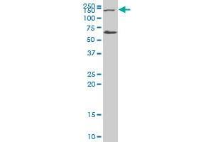 ADAMTS13 polyclonal antibody (A01), Lot # 051109JC01 Western Blot analysis of ADAMTS13 expression in HeLa .