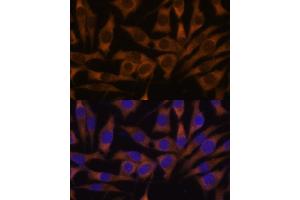 Immunofluorescence analysis of L929 cells using IGF2BP3 antibody (ABIN6131800, ABIN6142245, ABIN6142246 and ABIN6221706) at dilution of 1:100.