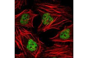Confocal immunofluorescence analysis of Hela cells using HDAC3 mouse mAb (green). (HDAC3 anticorps  (AA 224-428))
