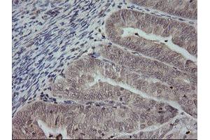 Image no. 2 for anti-Mitogen-Activated Protein Kinase Kinase 3 (MAP2K3) antibody (ABIN1499403)