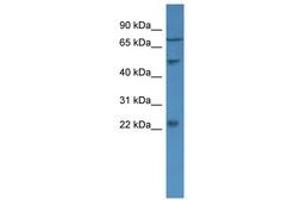 Image no. 1 for anti-Guanylate Cyclase Activator 1B (Retina) (GUCA1B) (AA 34-83) antibody (ABIN6746667) (GUCA1B anticorps  (AA 34-83))