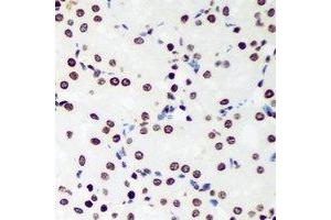 Immunohistochemical analysis of Sox-5 staining in rat kidney formalin fixed paraffin embedded tissue section.