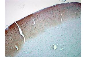 Immunohistochemistry analysis using Mouse Anti-CaMKII Monoclonal Antibody, Clone 6G9 (ABIN361643 and ABIN361644). (CAMKII gamma anticorps)