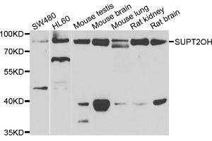 Western blot analysis of extracts of various cell lines, using SUPT20H antibody. (FAM48A/P38IP anticorps)
