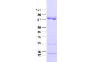 Validation with Western Blot