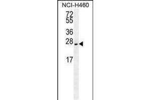 EIF4E2/M antibody (ABIN659116 and ABIN2843758) western blot analysis in NCI- cell line lysates (35 μg/lane). (EIF4E2 anticorps)