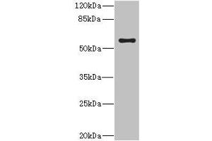CYP4V2 anticorps  (AA 246-525)