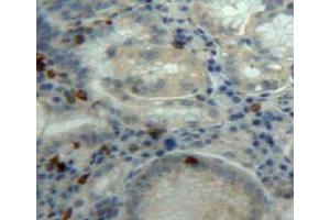 Used in DAB staining on fromalin fixed paraffin-embedded stomach tissue