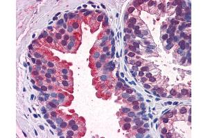 Immunohistochemistry (IHC) image for anti-Kelch-Like ECH-Associated Protein 1 (KEAP1) (N-Term) antibody (ABIN2775978)