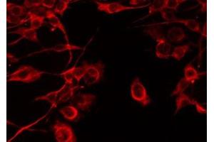 ABIN6277527 staining Hela by IF/ICC. (C1QB anticorps  (Internal Region))