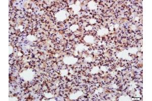 Paraformaldehyde-fixed, paraffin embedded rat lung tissue, Antigen retrieval by boiling in sodium citrate buffer(pH6) for 15min, Block endogenous peroxidase by 3% hydrogen peroxide for 30 minutes, Blocking buffer (normal goat serum) at 37°C for 20min, Antibody incubation with Rabbit Anti-eIF2 alpha Polyclonal Antibody, Unconjugated  at 1:500 overnight at 4°C, followed by a conjugated secondary and DAB staining