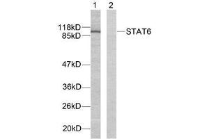 Western blot analysis of extracts from HeLa cells using STAT6 (Ab-641) antibody (E021050). (STAT6 anticorps)