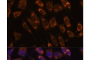 Immunofluorescence analysis of L929 cells using SEC61B Polyclonal Antibody at dilution of 1:100. (SEC61B anticorps)