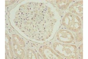 Immunohistochemistry of paraffin-embedded human kidney tissue using ABIN7173675 at dilution of 1:100 (TUBB1 anticorps  (AA 270-451))