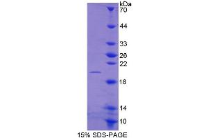 SDS-PAGE of Protein Standard from the Kit (Highly purified E. (MMP13 Kit CLIA)