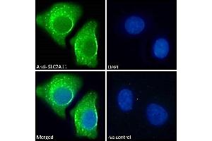 ABIN190899 Immunofluorescence analysis of paraformaldehyde fixed A549 cells, permeabilized with 0. (SLC7A11 anticorps  (Internal Region))