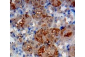 Used in DAB staining on fromalin fixed paraffin-embedded Kidney tissue (IL1RL1 anticorps  (AA 357-532))