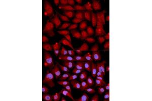 Immunofluorescence analysis of U2OS cell using MAP2K6 antibody. (MAP2K6 anticorps  (AA 1-334))
