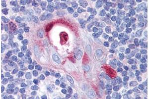 Human Thymus: Formalin-Fixed, Paraffin-Embedded (FFPE)