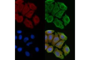 ABIN6257000 and ABIN6274216 staining Hela cells(45 min of heat-shock) by IF/ICC. (RPL10 anticorps  (N-Term))