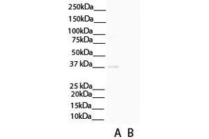 WB Suggested Anti-C1QTNF3 Antibody Titration: 0. (C1QTNF3 anticorps  (N-Term))