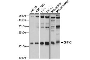 Western blot analysis of extracts of various cell lines, using CNPY2 antibody. (CNPY2/MSAP anticorps  (AA 1-182))