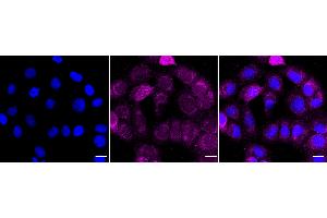 anti-Heat Shock 105kDa/110kDa Protein 1 (HSPH1) antibody