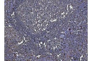 IHC analysis of HLA-DRA using anti-HLA-DRA antibody (ABIN7600950).