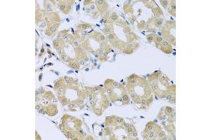 Immunohistochemistry of paraffin-embedded human stomach using SYT4 antibody at dilution of 1:100 (x40 lens). (SYT4 anticorps)