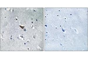 Immunohistochemistry analysis of paraffin-embedded human brain tissue, using GluR1 (Ab-849) Antibody.