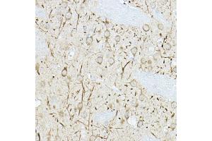 Immunohistochemistry of paraffin-embedded rat brain using DUSP6 Rabbit pAb (ABIN3017520, ABIN3017521, ABIN3017522 and ABIN6220131) at dilution of 1:100 (40x lens).