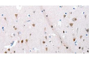 Immunohistochemistry of paraffin-embedded Human brain using POMC Polyclonal Antibody at dilution of 1:30
