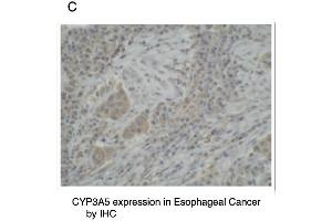 C. (CYP3A5 anticorps  (C-Term))