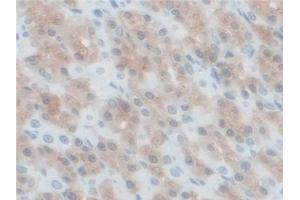 Detection of BCKDK in Rat Stomach Tissue using Polyclonal Antibody to Branched Chain Alpha-Ketoacid Dehydrogenase Kinase (BCKDK) (BCKDK anticorps  (AA 44-223))