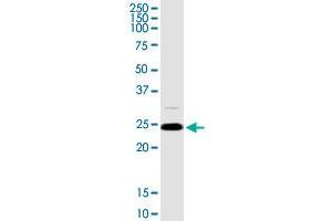 ARHGDIA MaxPab rabbit polyclonal antibody. (ARHGDIA anticorps  (AA 1-204))