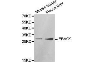 Western blot analysis of extracts of various cell lines, using EBAG9 antibody. (RCAS1 anticorps)