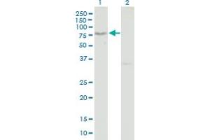 Western Blot analysis of TCIRG1 expression in transfected 293T cell line by TCIRG1 MaxPab polyclonal antibody.