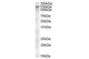Image no. 1 for anti-Solute Carrier Family 12 (Potassium-Chloride Transporter) Member 4 (SLC12A4) (Internal Region) antibody (ABIN374882) (SLC12A4 anticorps  (Internal Region))