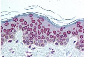 Human Skin (formalin-fixed, paraffin-embedded) stained with LMNA antibody ABIN291872 at 1:50 followed by biotinylated goat anti-rabbit IgG secondary antibody ABIN481713, alkaline phosphatase-streptavidin and chromogen. (Lamin A/C anticorps  (C-Term))