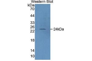 Western blot analysis of the recombinant protein. (PTPRN2 anticorps  (AA 839-1015))