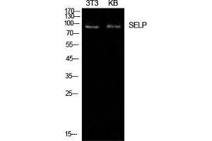 Western Blot (WB) analysis of NIH-3T3, KB cells using P-Selectin Polyclonal Antibody.