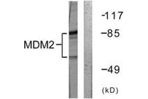 Western blot analysis of extracts from COS7 cells, using MDM2 (Ab-166) Antibody. (MDM2 anticorps  (AA 132-181))